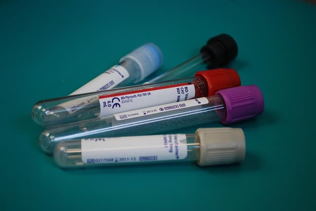 Top 5 des équipements de santé connectés à avoir chez soi